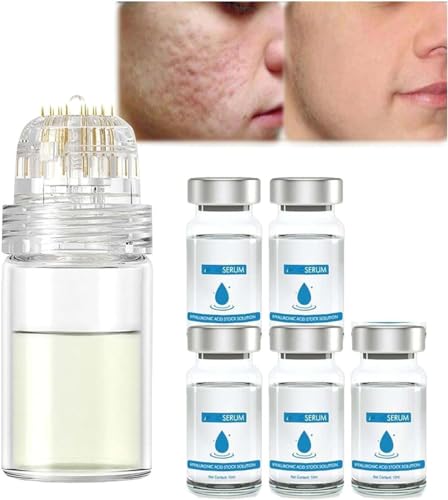 Système de micro-infusion pour le visage, système de micro-infusion pour les lèvres, rouleau de microfléchettes à l'acide hyaluronique Pockmarksheal,micro système pour le visage (5)