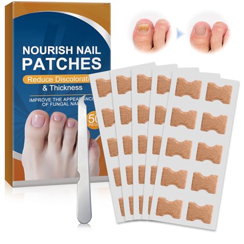 50 Pièces Autocollants de Correction des Ongles Incarnés, Pansement Ongle Incarné, Patch Correcteur D'ongle D'orteils Conviennent pour les Ongles Abîmés...
