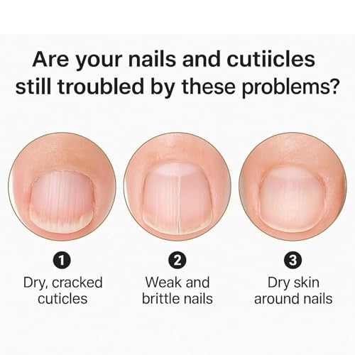 Stop Butting un oggi - Solchat para tratamiento de 4 ml, fórmula protectora suave | Prevención segura con aplicación de secado rápido, solución útil para mujeres, hombres, cuchinos de poll - imagen 8