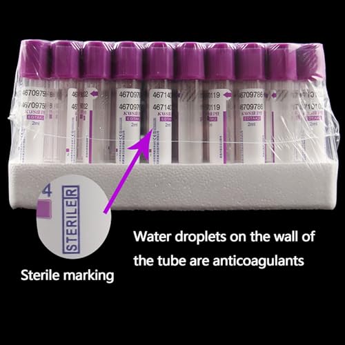 EDTAK2 - Provette sottovuoto per raccolta del sangue, 100 pezzi, 5 ml/10 ml, con tappo a vite viola, per uso in laboratorio