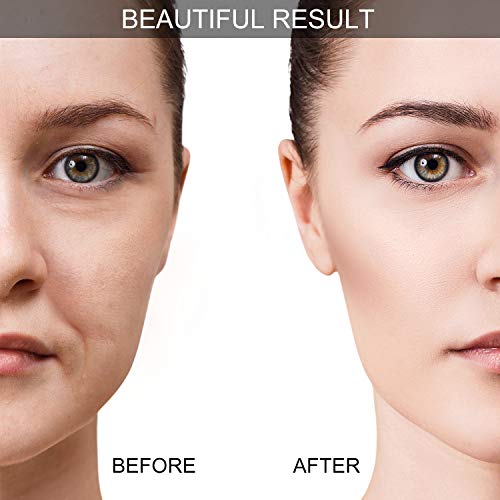 Silicone Facial Cupping Set, Vacuum Massage Cup Kit For Body, Face, Neck, Back, Eye, 6 Cups And Exfoliating Brush For Skin Care, Anti-Aging And Anti-Wrinkle Beauty Tool (Small Medium, White) #TOP2