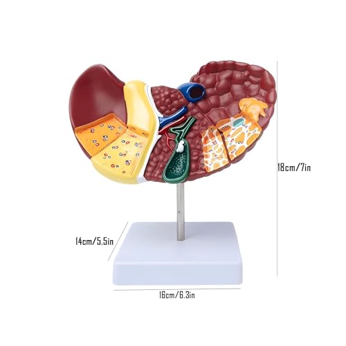 Modelo de hígado de anatomía patológica con textura clara y piezas desmontables 6