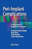 Peri-Implant Complications: A Clinical Guide to Diagnosis and Treatment