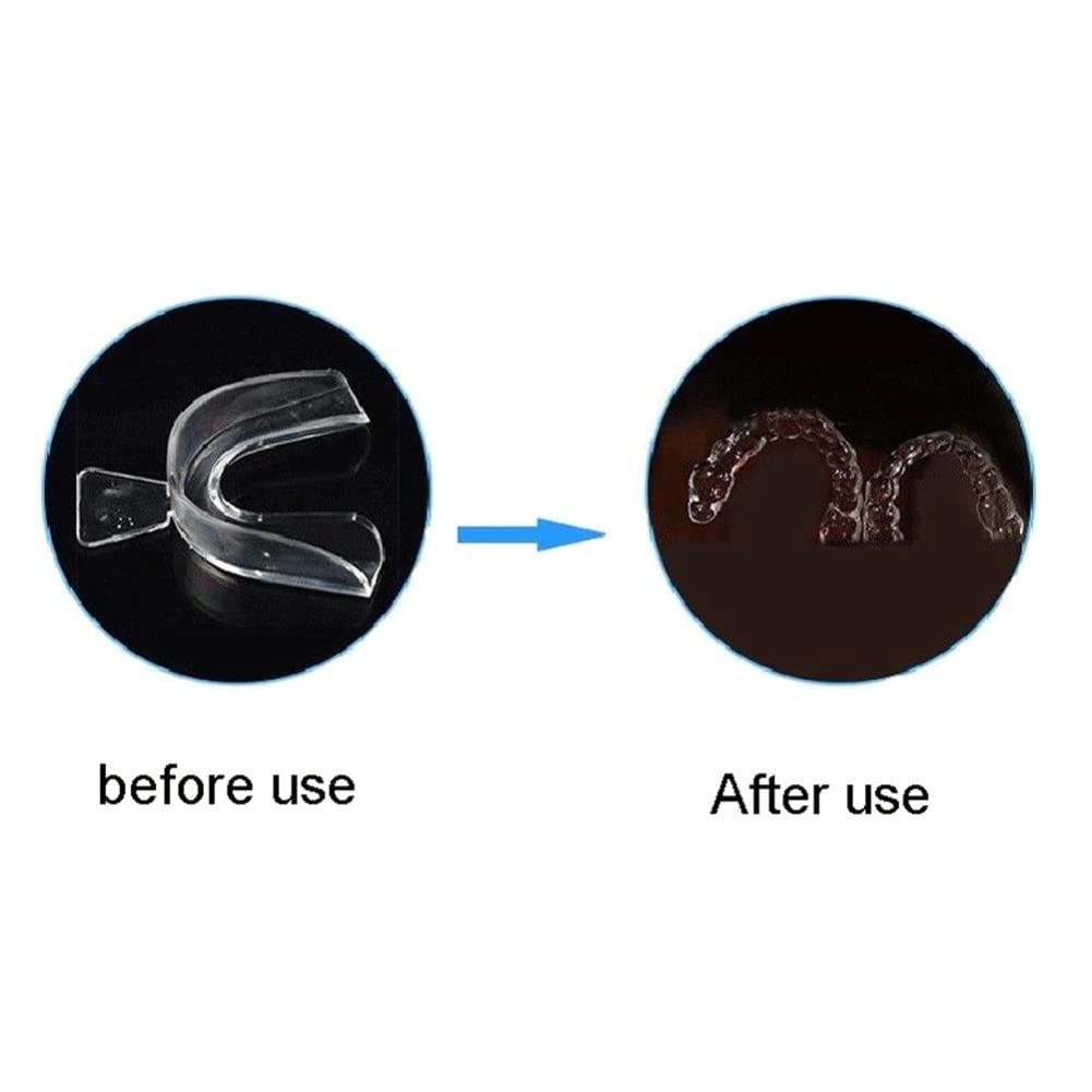 1/2/4pcs Soft Silicone Tooth Orthodontic Braces Set Mouth Guard Protector Dental Teeth Whitening Trays Retainers Oral Hygiene Care (4pc) 2