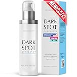 EnaSkin Dark Spot Remover Serum for Face & Body with Niacinamide, Vitamin C, Alpha-Arbutin, Vitamin E & Tranexamic Acid – Lightweight Daily Skincare for Women & Men (1.7 Fl Oz)