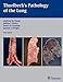 Thurlbeck's Pathology of the Lung