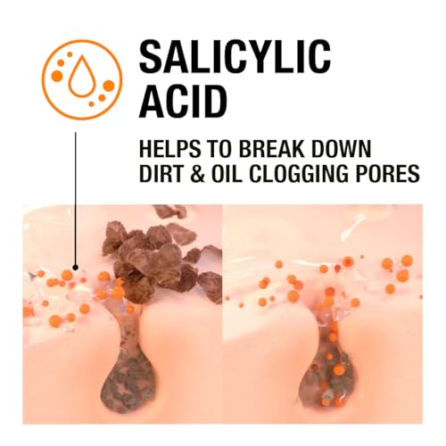 Neutrogena Clear and Defend SOS Gel (15ml), Oil-Free Face Gel for Spot-Prone Skin, with Purifying 0.5% Salicylic Acid to Help Reduce the Appearance of Spots