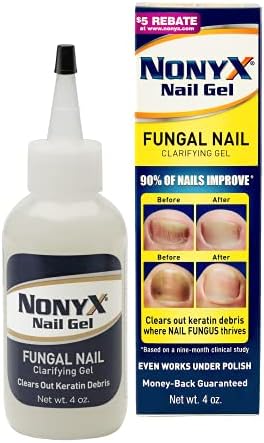 Nonyx Fungal Nail Clarifying Gel, a Toenail Fungus Treatment that Clears out Fungus by Removing Keratin Debris where Nail Fungus Grows, 90% of Nails Improve, 4 fl oz