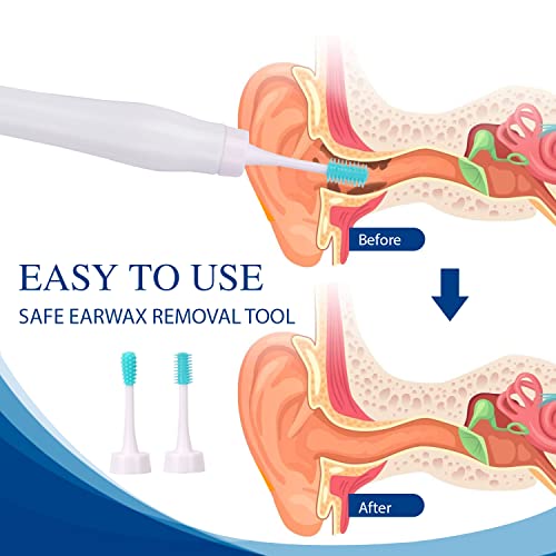 Earwax Remover Soft Silicone Ear Cleaning Tool Earwax Removal Tool With 4 Brush Head And 4 Q Grips Tips + 4Pcs Metal Ear Picker Set, Safe And Effective To Remove Ear Wax For Adults #TOP6