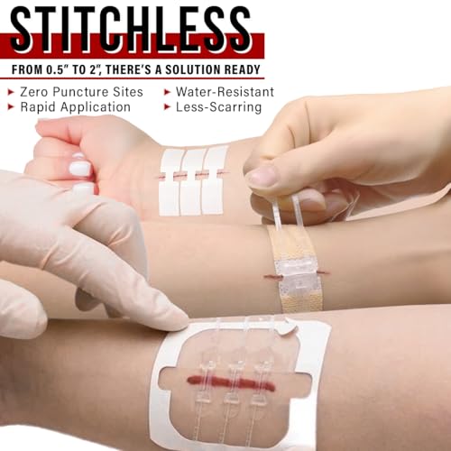 Image of EVERLIT Wound Closure Kit | Surgical Zip-Stitch Devices for Cut & Laceration | Sterile, Suture-Free, Stitch-Less Adhesive Butterfly Bandages for Emergency First Aid Wound Care (Ultimate Pro+ Kit)