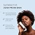 YOUR Soothing Day Cream- Daily Facial Moisturizer SPF30 with Vitamin C, Lightweight & Reduce Acne Scar, Non Comedogenic, For Acne Prone Skin, 1.oz