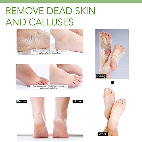 Foot Peel Mask - Baby Soft Skin Foot Mask - Remove Dead Skin | Foot Spa Foot Care Women's Peeling Mask With Lavender Men's And Women's Foot Peeling Mask Exfoliating (2 Pairs) #TOP4