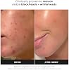 Exfoliante líquido Paula's Choice SKIN PERFECTING 2% BHA | Exfoliante facial suave con ácido salicílico para puntos negros, poros dilatados, arrugas y líneas finas 4