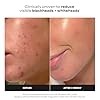 Paula's Choice SKIN PERFECTING 2% BHA Liquid Exfoliant with Salicylic Acid, Facial Polish for Pores, Wrinkles & Fine Lines, Suitable for Blackhead-Prone Skin, Fragrance-Free #1
