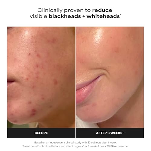 Paula's Choice SKIN PERFECTING 2% BHA Liquid Exfoliant with Salicylic Acid, Facial Polish for Enlarged Pores, Wrinkles & Fine Lines, Suitable for Blackhead-Prone Skin, Fragrance-Free - Image 3