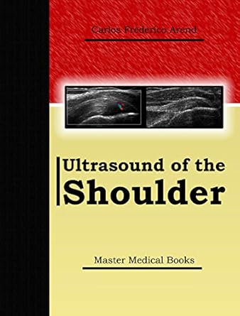 Essential Guide to Shoulder Imaging: A Comprehensive Review of Ultrasound of the Shoulder (Musculoskeletal Ultrasound Series) Essential Guide to Shoulder Imaging: A Comprehensive Review of Ultrasound of the Shoulder (Musculoskeletal Ultrasound Series)