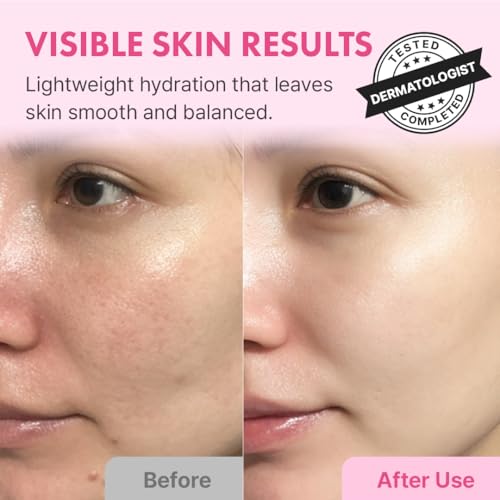 Hanskin Hyaluron Skin Essence Toner – Korean Hydrating Toner for Glass Skin | Hyaluronic Acid & Collagen | Lightweight Moisturizing Astringent for Dry, Sensitive & Dull Skin | K-Beauty (5.07 fl oz) - Image 3