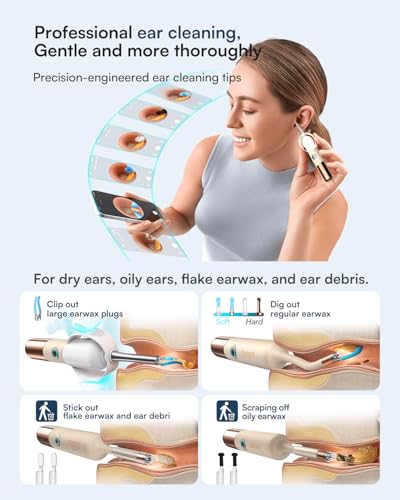 Image of Bebird Earsight Ultra 2K Ear Wax Removal Tool Camera,Pain-Free Ear Cleaner with HD Otoscope,Visual Ear Pick Tweezers, Safe Silicone Tips,Ear Cleaning Kit for Family, FSA HSA Eligible (Champagne Gold)