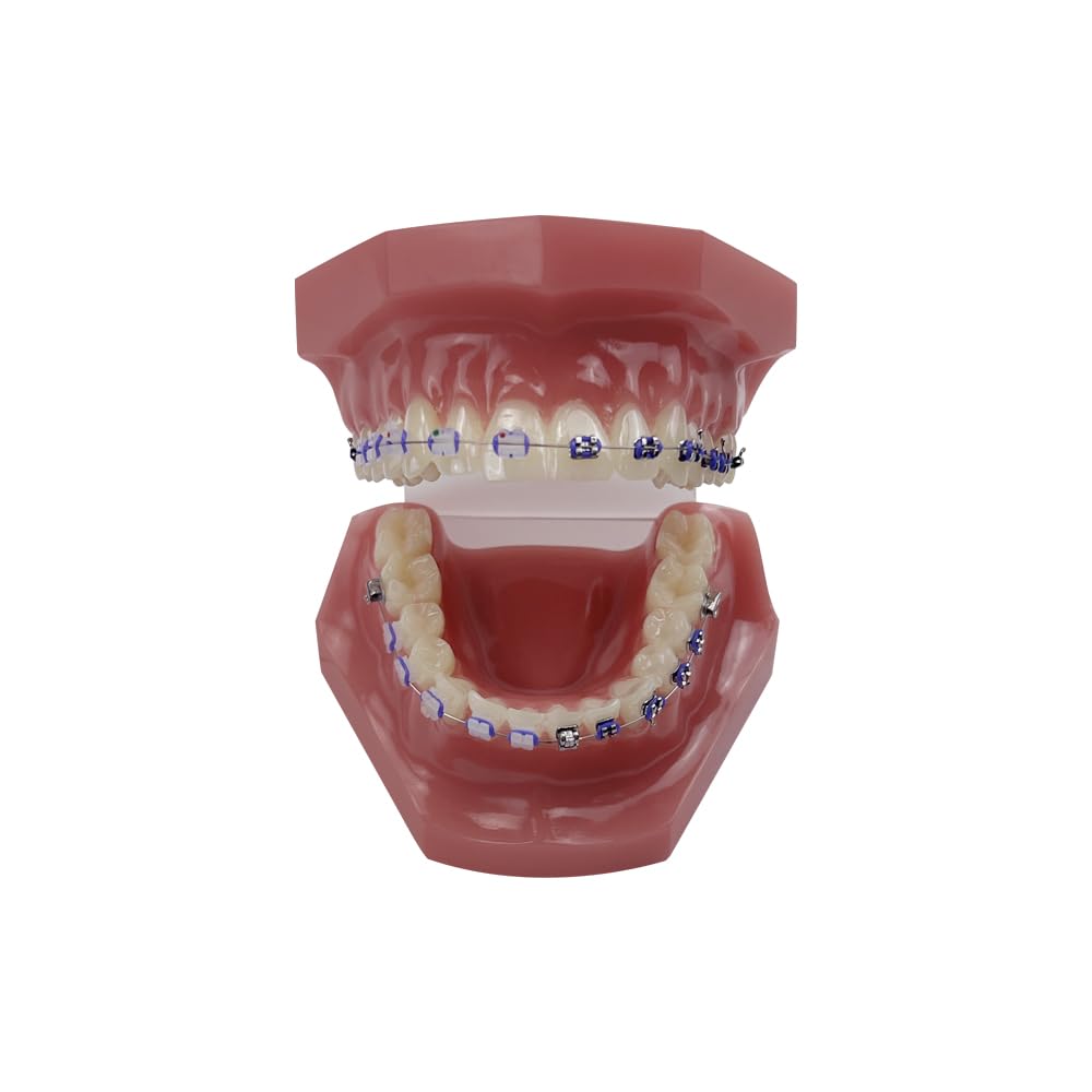 Orthodontisches Zahnmodell mit Halterungen, YOUYA DENTAL Demonstration Orthodontisches Modell für Bildung, Zähne Demonstration Typodonte Anatomisches Lehrwerkzeug mit Metall und Keramischer Halterung