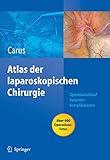 laparoskopische fundoplicatio  Operationsatlas Laparoskopische Chirurgie: Indikationen - Operationsablauf - Varianten - Komplikationen Mit Single Access Surgery