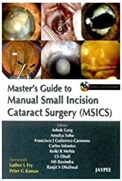 Master’s Guide to Manual Small Incision Cataract Surgery (MSICS)