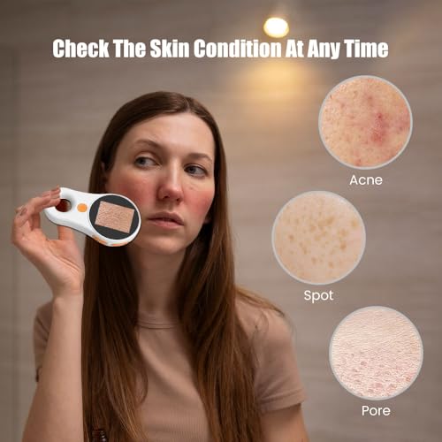 Image of Handheld Dermatoscope Skin Analyzer Machine, Wireless Portable Digital Microscope with 1080P IPS Screen 8 LEDs, 500X Magnifier, for Scalp /Hair Trichomes Facial Skin Dermatoscope