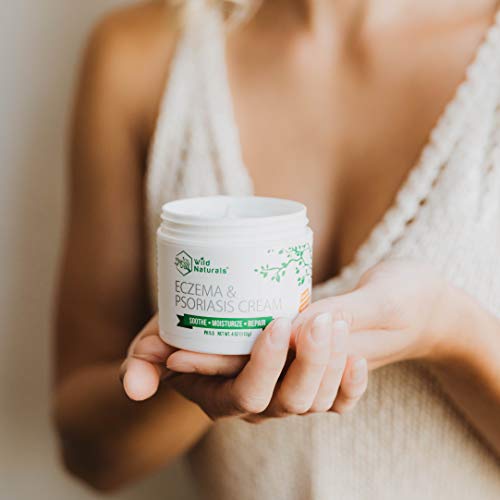 Eczema Cream For Adults And Kids - Eczema Face Cream For Sensitive Skin - Psoriasis Body Cream For Dry And Itchy Skin - Anti Itch Cream For Psoriasis, Seborrheic Dermatitis, Rosacea, Eczema Relief #TOP5