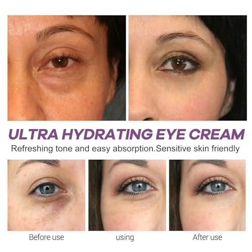 Hydrating Eye Cream for Dry Eye,Retinol Eye Cream for Puffy Eye,Anti Aging Eye Cream with Nicotinamide,Fade Dark Circle & Puffy Eye - Image 5