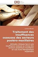 Traitement des insuffisances osseuses des secteurs postéro-maxillaires 6131501769 Book Cover