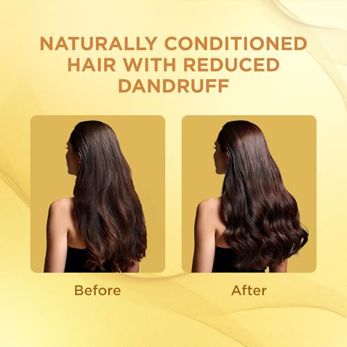 Image of Medimix Total Care Shampoo 200 Ml (Pack of 2) for Men & Women | Minimize Hairfall, Fight Dandruff with Hair Conditioning | Infused with 9 Herbal Ingredients
