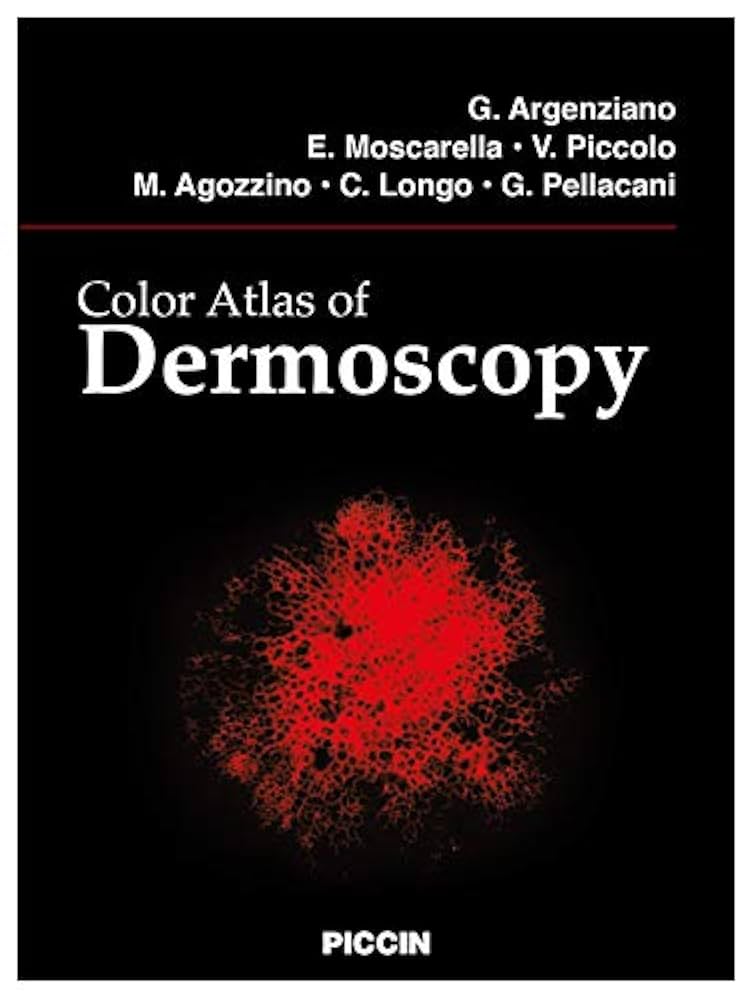 カラーアトラスDermoscopy Color Atlas of Dermoscopy: G. ARGENZIANO, E. MOSCARELLA, V