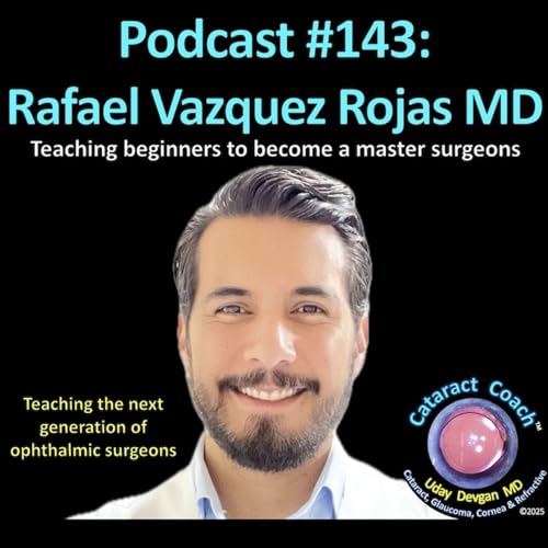 143: CataractCoach Podcast 143: Rafael Vazquez Rojas MD Podcast Por  arte de portada