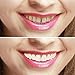Imako Cosmetic Teeth for Women 1 Pack. (Small, Natural) Uppers Only- Arrives Flat. Fit at Home Do it Yourself Smile Makeover!