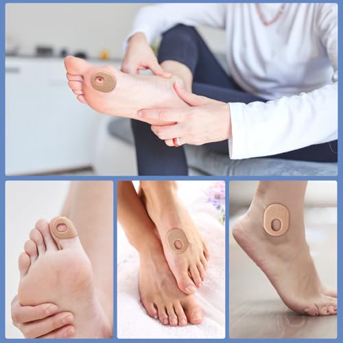 Image of 24Pcs Callus Pads，Soft Felt Callus Oval Shape Cushion Pads for Toes and Feet, Reduce Pain, Pressure and Friction from Shoes