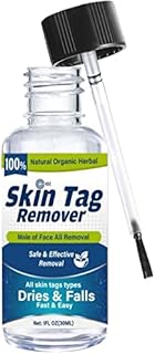 Skin Tag Remover, Skin Tag Removal, Mole remover, Wart remover, Easy at Home,