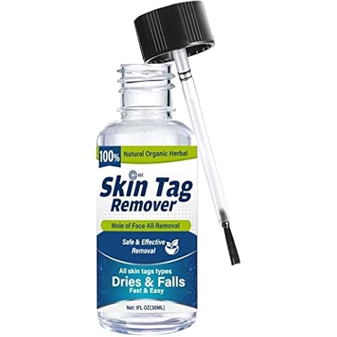 Skin Tag Remover, Skin Tag Removal, Mole remover, Wart remover, Easy at Home Cover