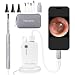 Otoscope iPhone, Teslong Upgraded 4.3mm HD Ear Microscope Inspection Camera, Ear Scope with 6 Adjustable LED Lights for iPhone, iPad & Android Smart Phones