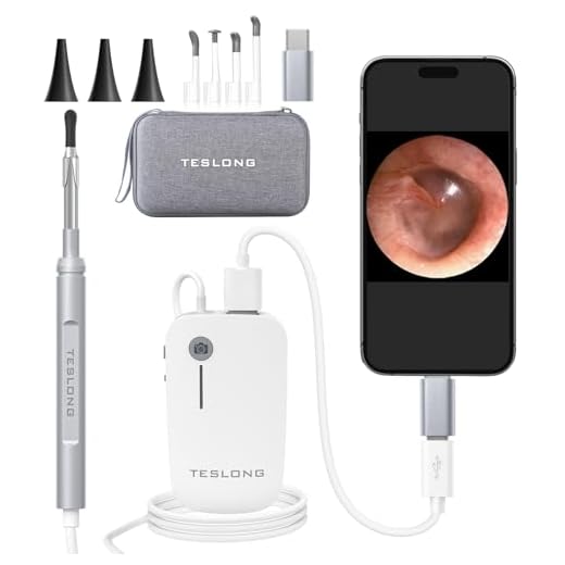 Teslong Otoscope iPhone, 4.3mm HD Inspection Camera, Ear Microscope, 6 Adjustable LED Lights with Ear Wax Removal Tools, Works with iPhone, iPad & Android