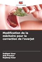 Modification de la mâchoire pour la correction de l'overjet (French Edition) 6208899192 Book Cover