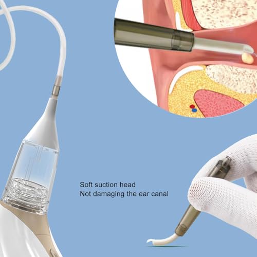 Kit per la Rimozione del Cerume con Aspirapolvere a 3 Livelli di Aspirazione, a Basso Rumore, Ricaricabile, Staccabile