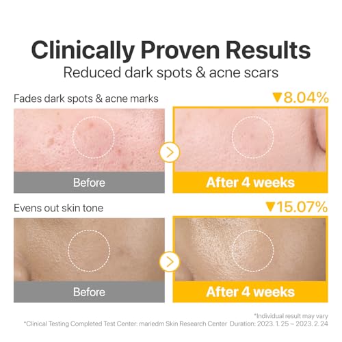 numbuzin No.5 Toner Pads | Vitamin-Niacinamide Concentrated Pad | Double-Sided | Glutathione, Niacinamide, PHA & LHA | Exfoliation, Hyperpigmentation Care | 70 Pads/180 ml - Image 4