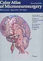 健康・医学 Micro-neurosurgical Atlas Color Atlas of Microneurosurgery: 9783131111029: Medicine