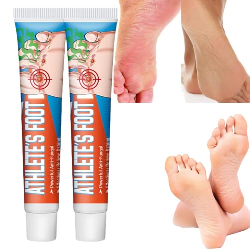 2PCS Athletes Foot Treatment,Anti Fungal Skin Cream,Antifungal Cream for Effective Anti-Itch,Itch Relief Cream,Foot Fungus Treatment,Itchy Skin Relief for Adults,Athletes Foot Cream Extra Strong