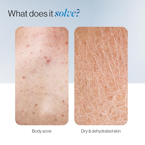 Image of Be Bodywise 1% Salicylic Ceramide Body Wash Shower Gel 200ml | Dual Pump, 2 in 1 Body Wash| For Body Acne, Strawberry Skin & Deep Hydration | 24 Hours Moisturization| Gentle, Non Drying & Paraben-Free