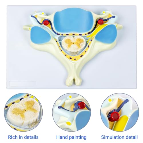 Image of EVOTECH SCIENTIFIC Enlarged Human Fifth Section Cervical Vertebra Anatomical Model with Spinal Cord, 7X Enlarged Transection Cervical Vertebra Model for Medical Learning Research Education Display