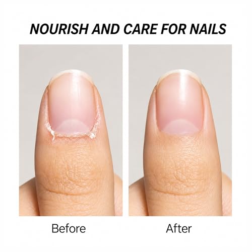 Image of SHILLS PROFESSIONAL Cuticle Softener 15ml | Professional Cuticle Remover for Manicure & Pedicure | Softens Dry, Rough Cuticles | Nail Care Solution for Natural, Gel & Acrylic Nails
