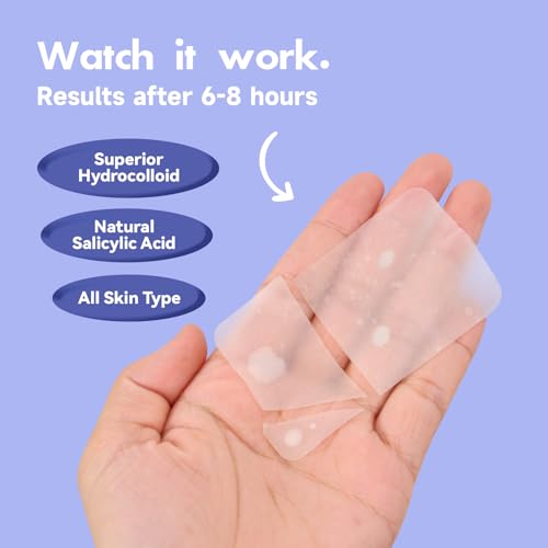 Dazzlook Adesivos de espinhas Ultra XL – Patch de ácido salicílico extra grande para cobrir manchas