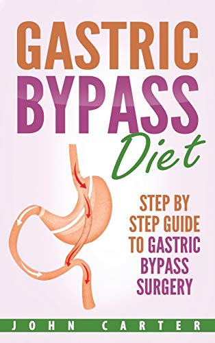 Gastric Bypass Diet: Step By Step Guide to Gastric Bypass Surgery: 2 (Bariatric Cookbook)