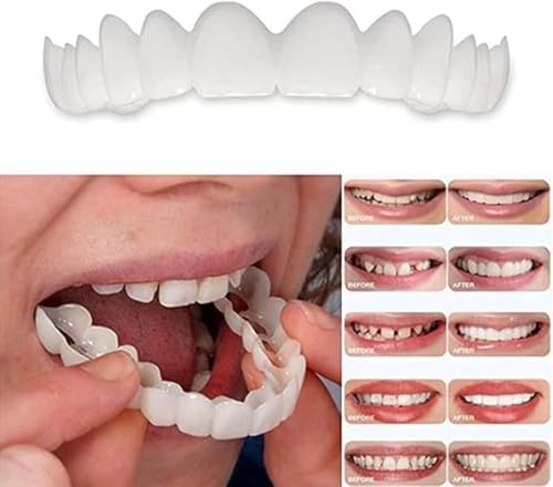Temporary Smile Solution - 2 Pairs, Adjustable & Comfortable, Restores Confidence for All‌ (2)
