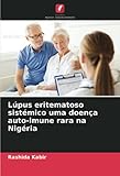 lupus eritematoso sistemico ppt  Lúpus eritematoso sistémico uma doença auto-imune rara na Nigéria